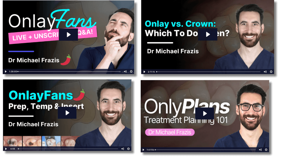 onlayfans ultimate collection image of the four lectures