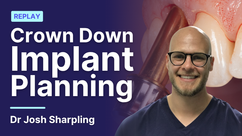 MKT-250725-Josh-implant-planning thumbnail Crown Down Implant Planning replay 