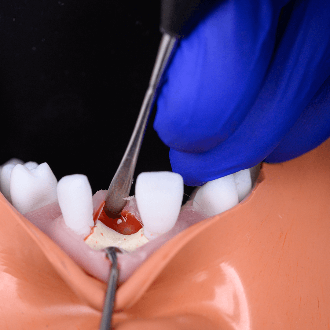 Modern Implantology Modern Implantology