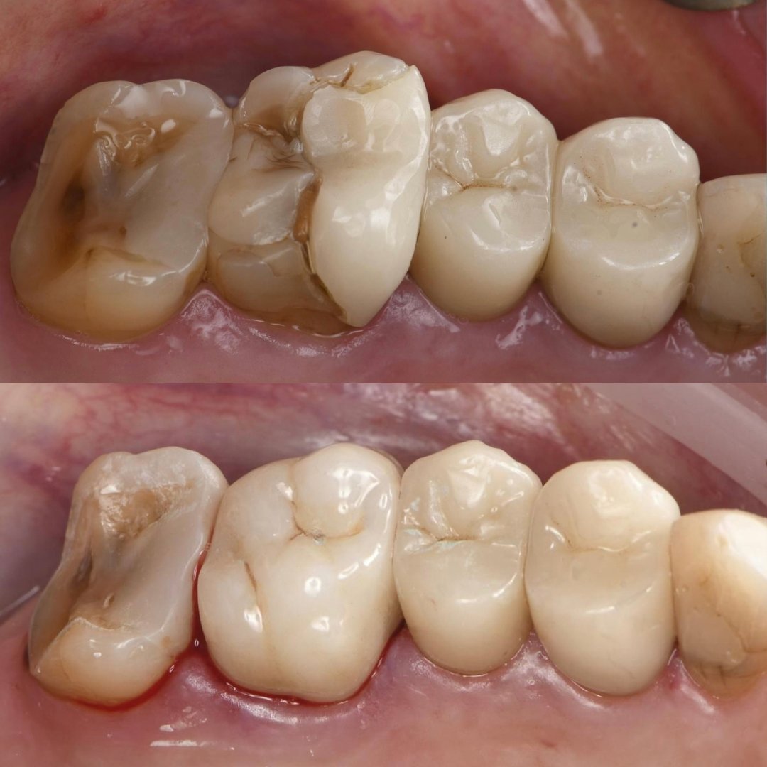 R-MC-230202-MF before after