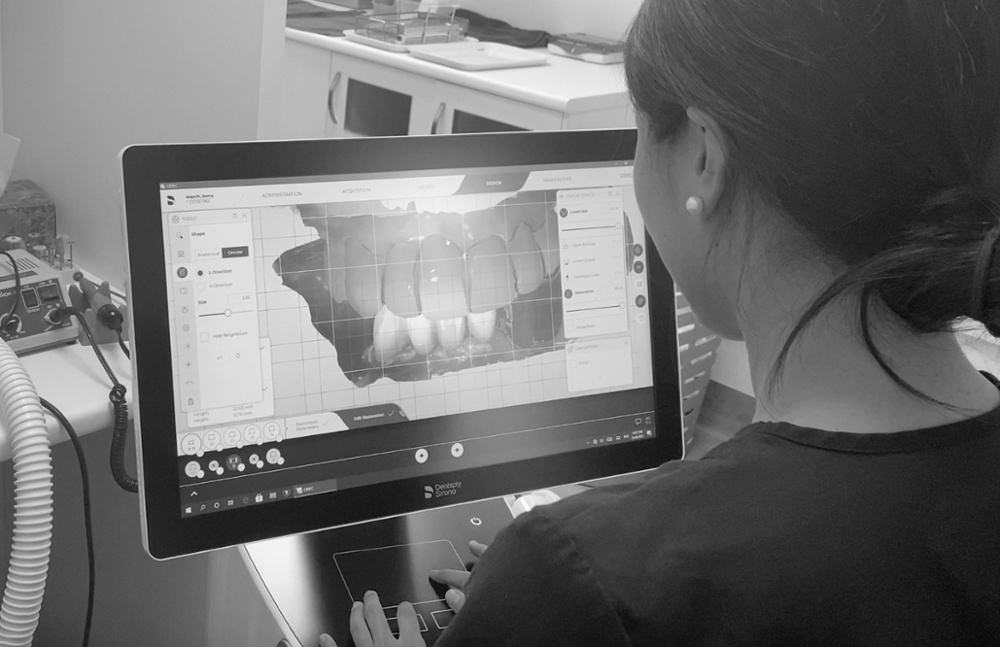 RGG-Digital-Dentistry-image-Alice-bw-2_2-1 RGG-Digital-Dentistry-image-Alice-bw-2_2-1