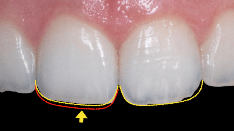 RIPE ORTHO.001 (1)