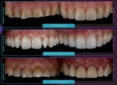 Smilefast-Photo-Cheat-part-1 Smilefast-Photo-Cheat-part-1