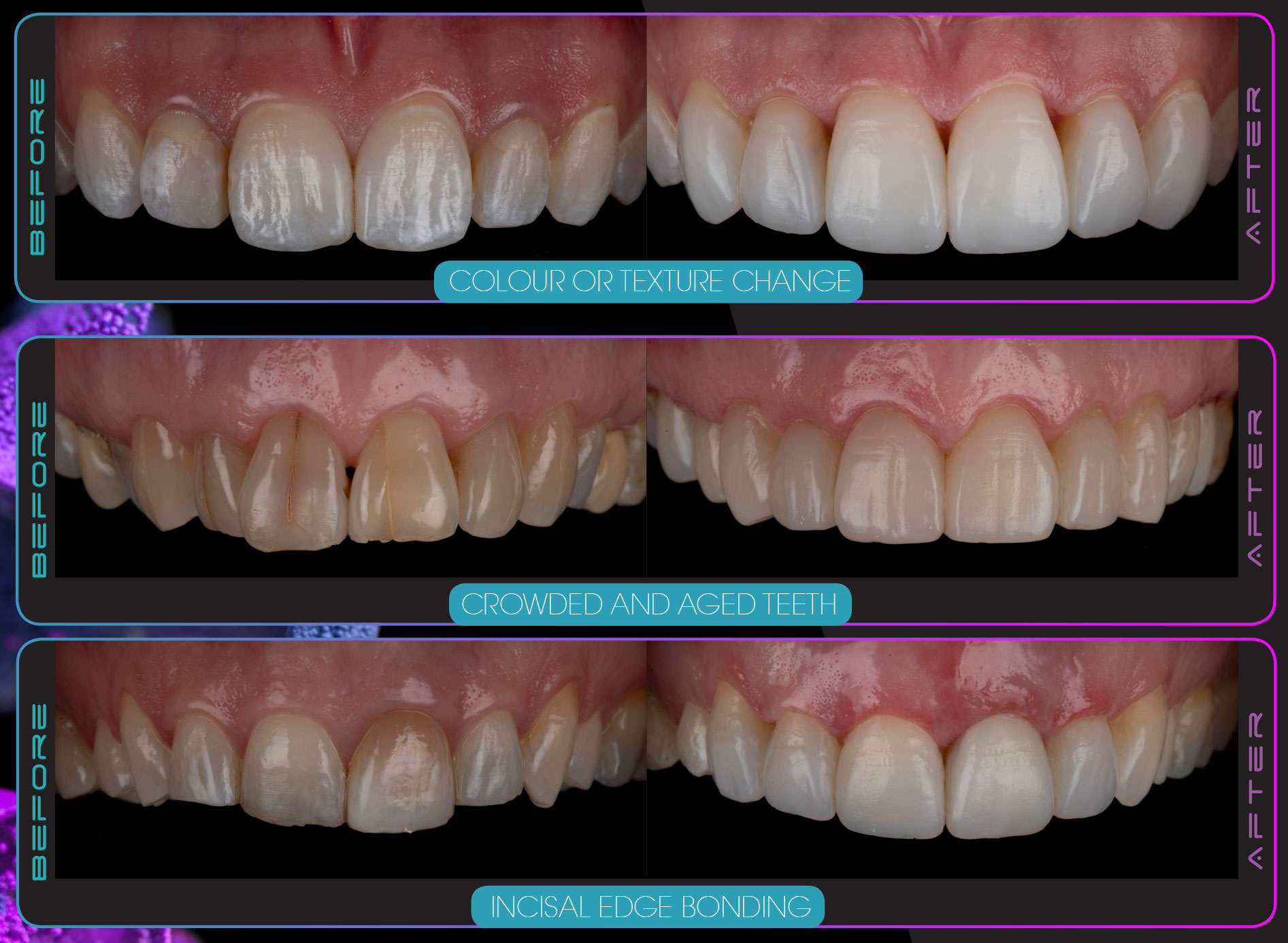 Smilefast-Photo-Cheat-part-2 Smilefast-Photo-Cheat-part-2