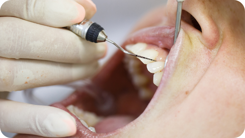 Thumbnail-Dipsciplines-of-dentistry-perio