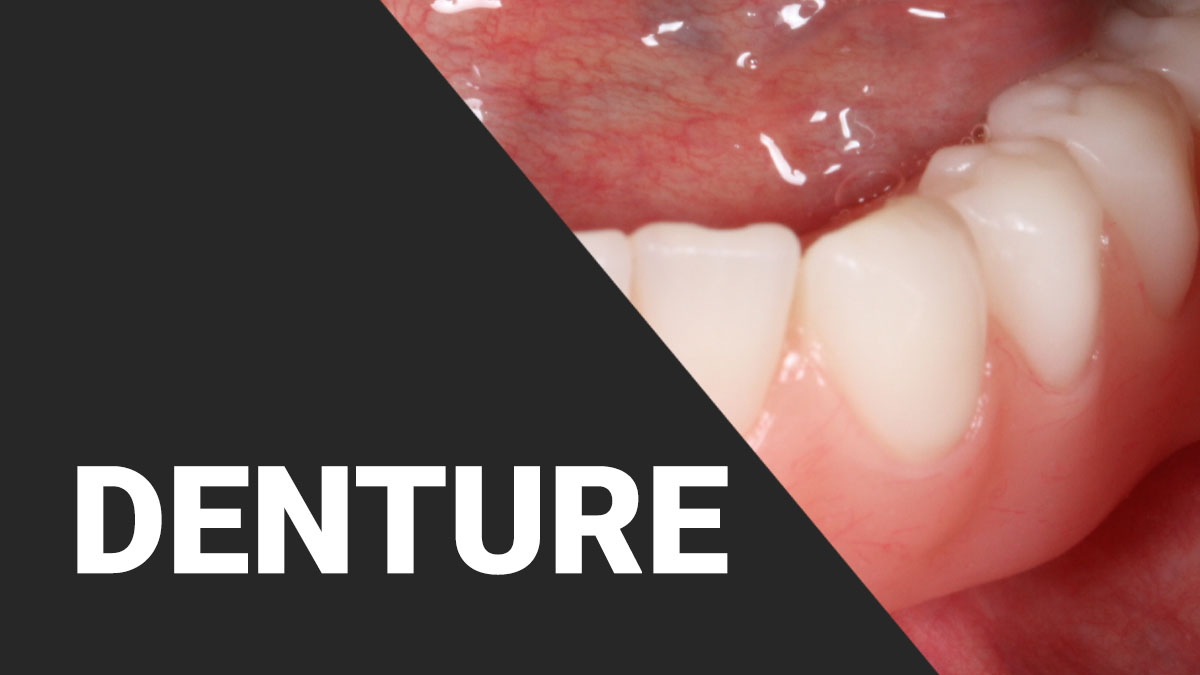 Denture Dental Training Videos