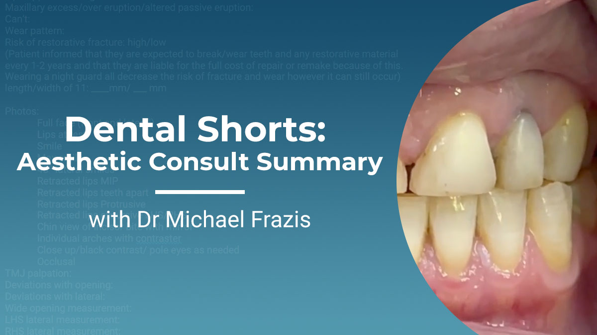 Dental Shorts - Aesthetic Consult Summary