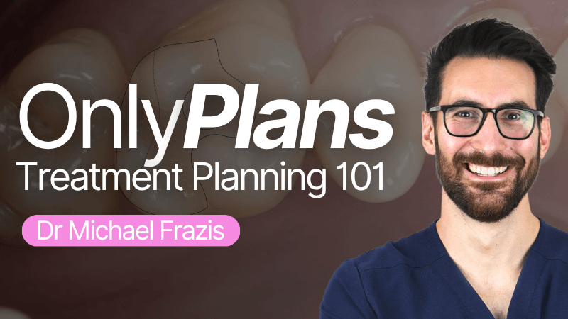 MKT-250613-Frazis OnlyPlans Treatment planning 101 thumbnail