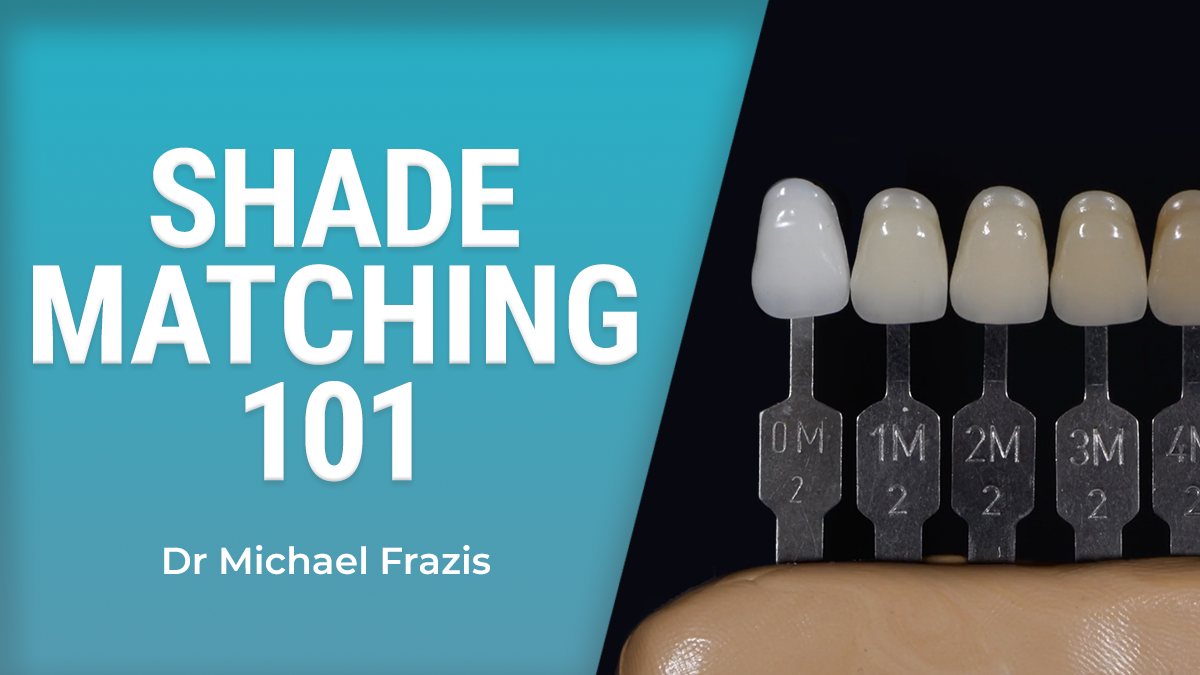 Shade Matching 101