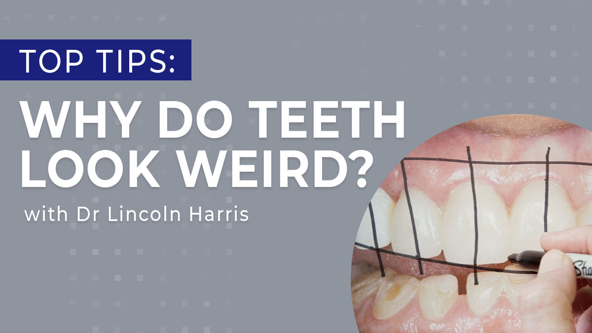 Top tips, why do teeth look weird?
