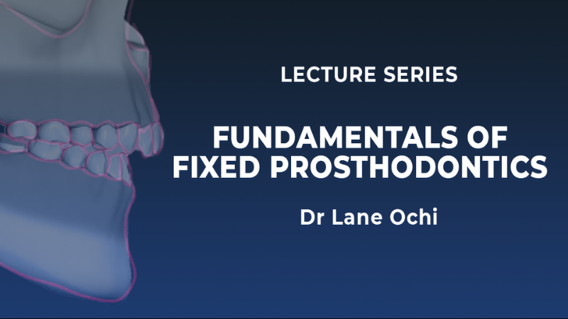 Fundamentals of Fixed Prosthodontics: Legacy vs Modern Concepts