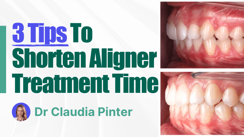 MKT-250820-Claudia Pinter thumbnail 3 Tips to Shorten Aligner Treatment Time