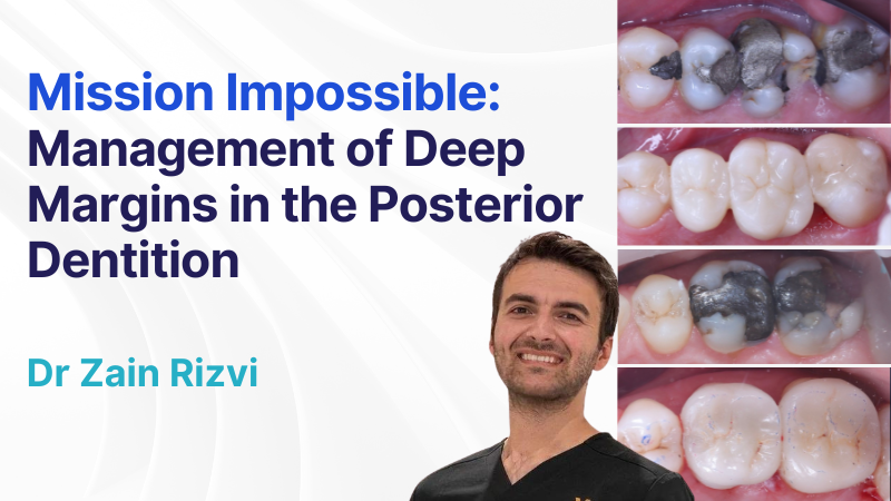 MC-251208-Zain- Mission Impossible NO DATE