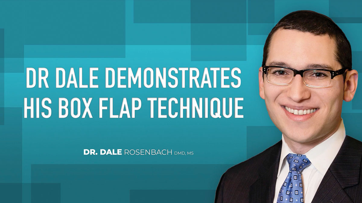 Box Flap
