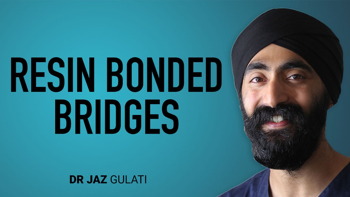 Resin Bonded Bridges