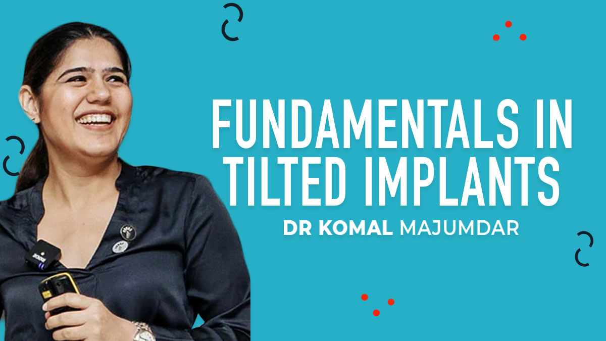 Fundamentals in Tilted Implants - Part 1