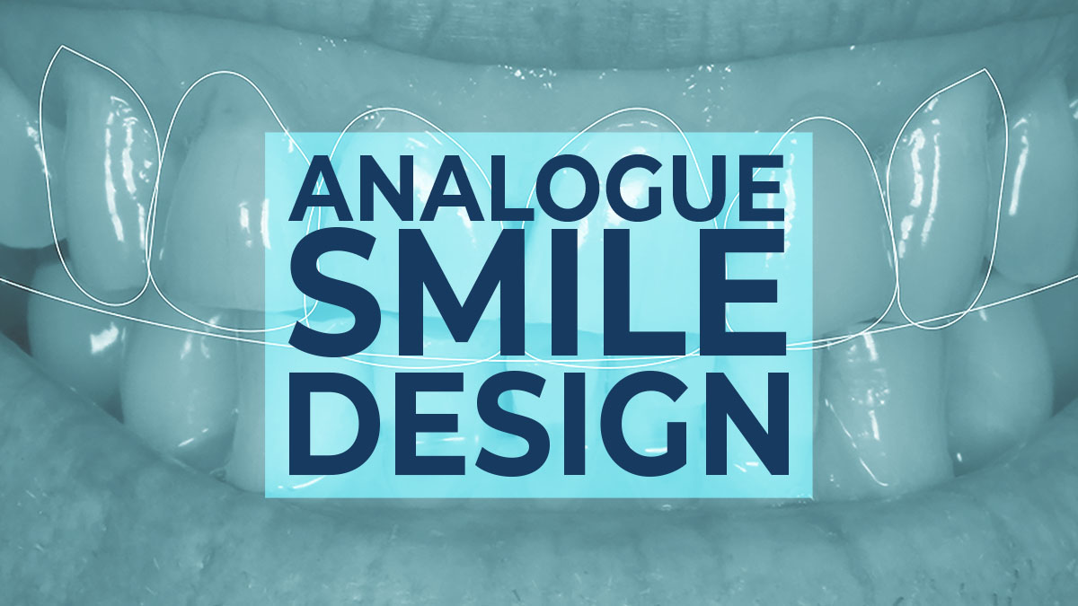 Analogue Smile Design
