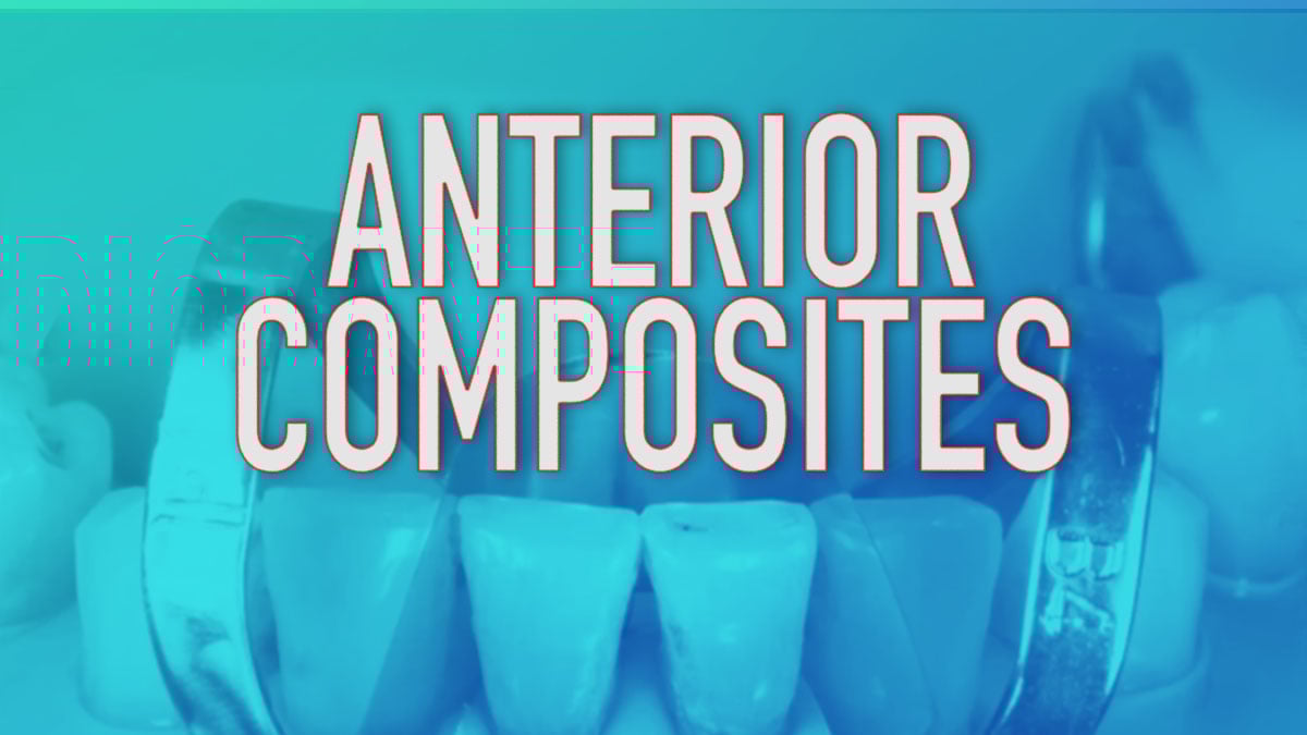 Anterior Composites
