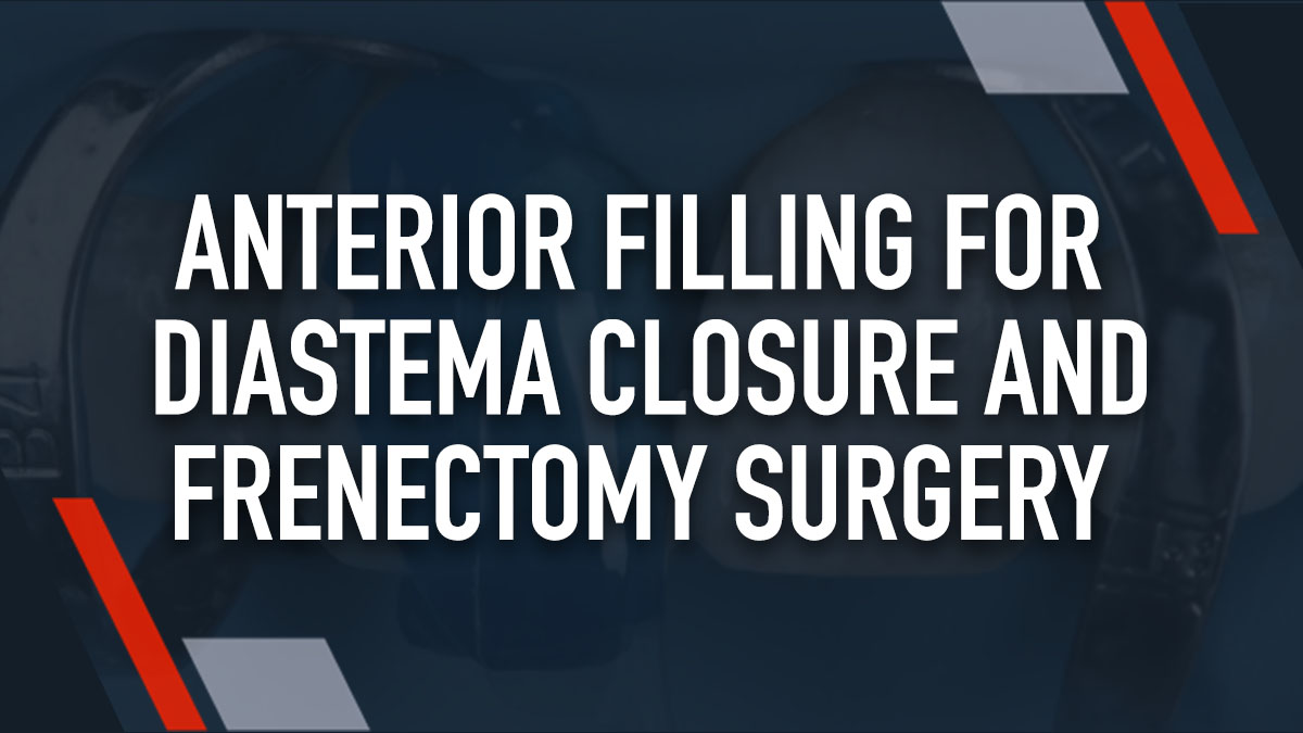 Anterior Filling for Diastema Closure and Frenectomy Surgery