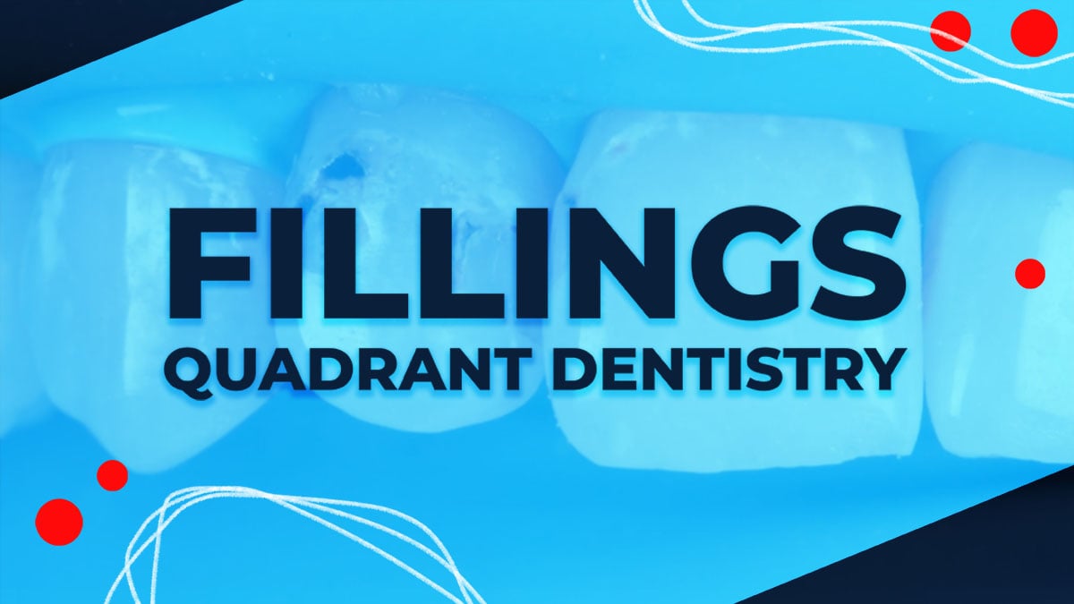 Fillings - Quadrant Dentistry