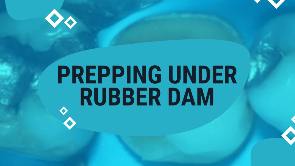 Prepping Under Rubber Dam