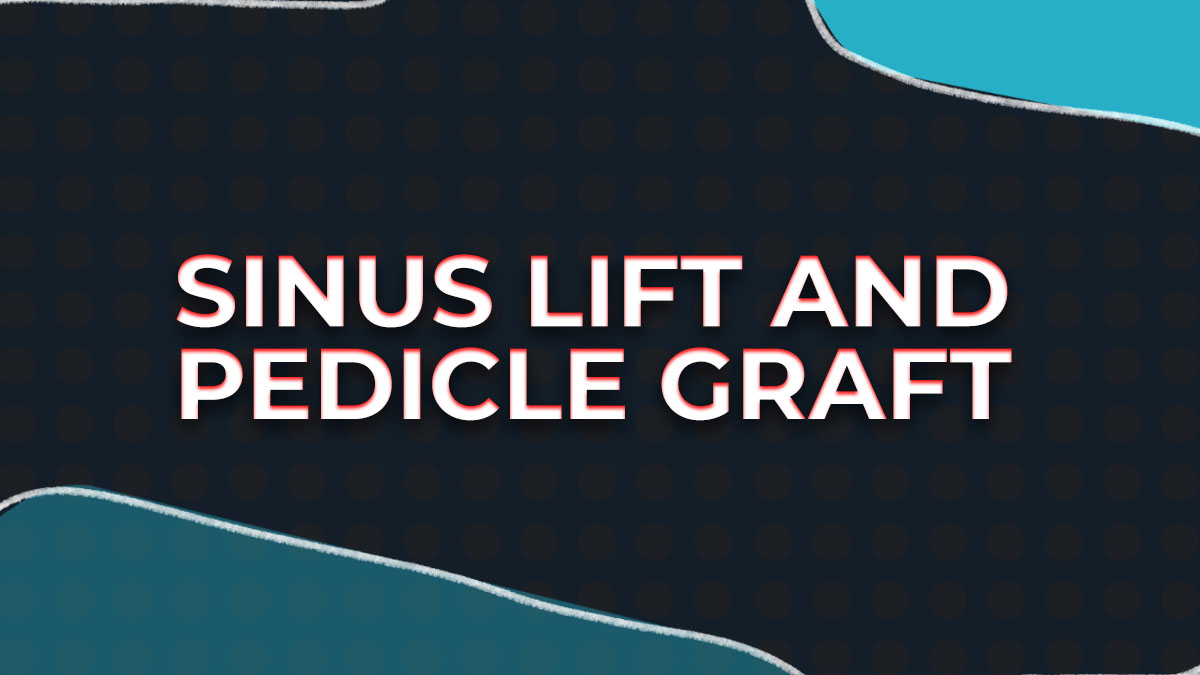 Sinus Lift and Pedicle Graft