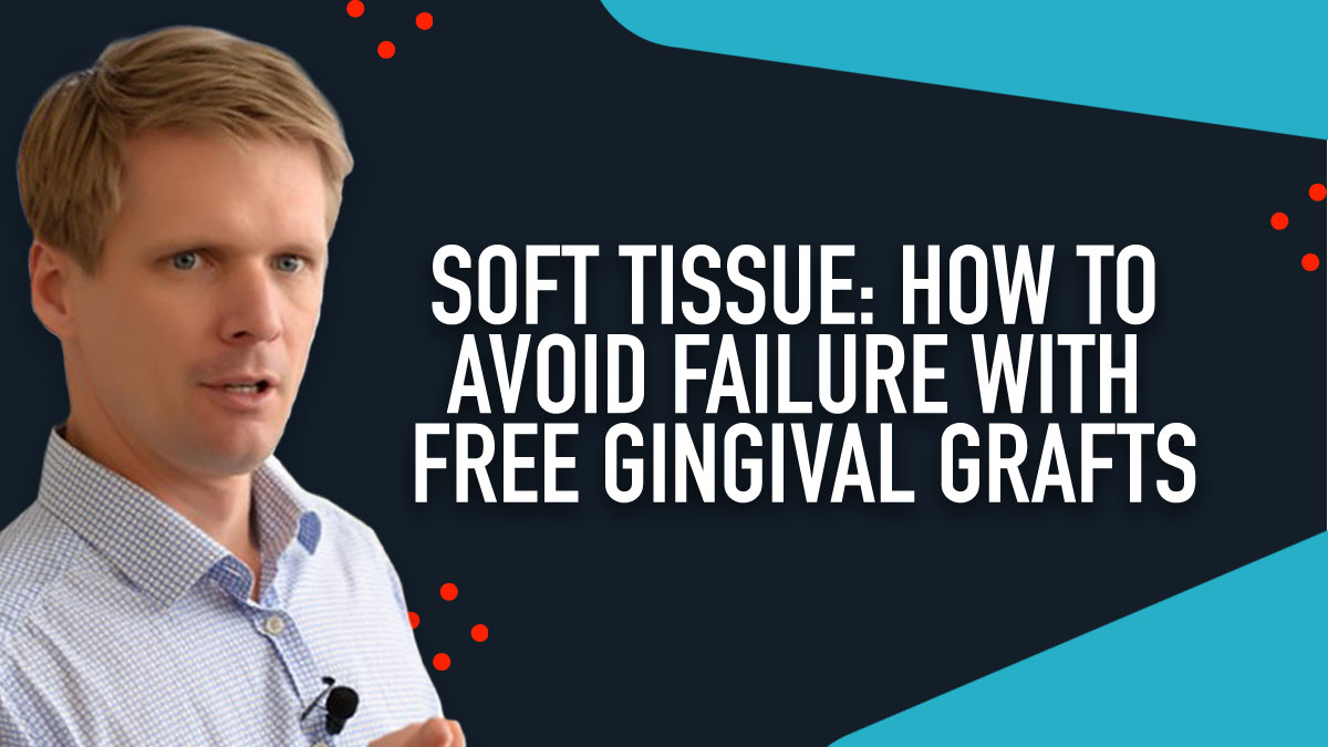 Soft Tissue - How to Avoid Failure with Free Gingival Grafts - Webinar
