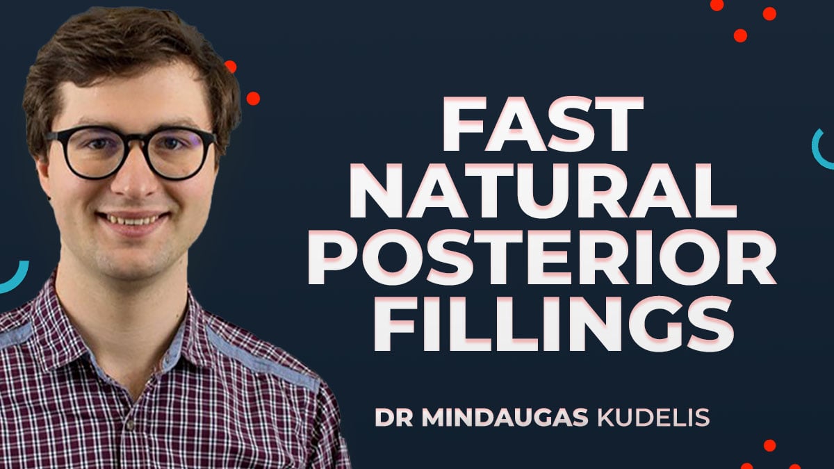 Fast Natural Posterior Fillings