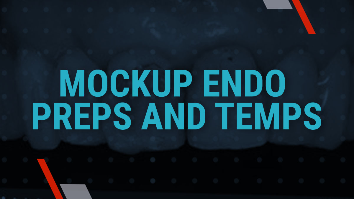 Mockup Endo Preps and Temps